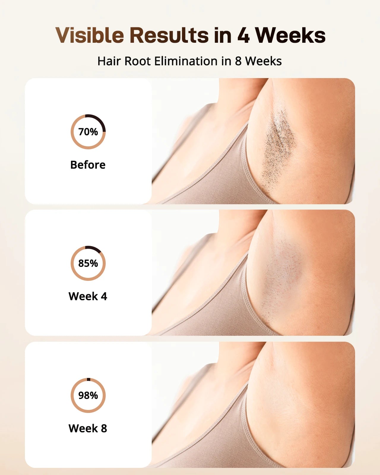 Laser Hair Removal Device – Ice Cooling & Full Body Treatment